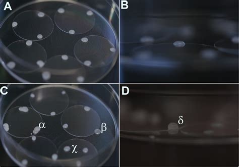 Low Density Primary Hippocampal Neuron Culture Video Jove Protocol