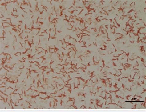 One Colony Forming Unit Cfu Of Bacteria Isolated Under Light