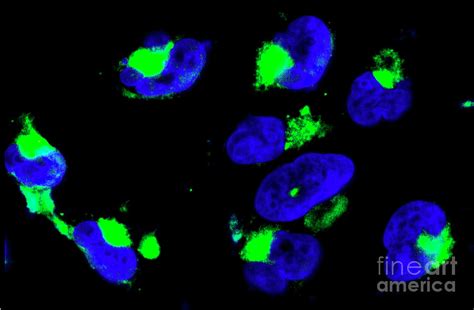 Nanoparticles In Glioma Cancer Cells Photograph By National Cancer