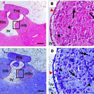 Photomicrograph of the habenula of the GCR: A&B. The habenulae showing... | Download Scientific ...