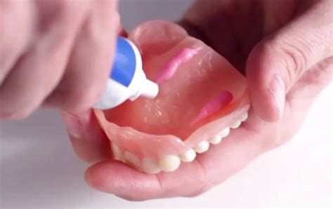 Dental Glue Your Quick Guide To Proper Usage And Tips