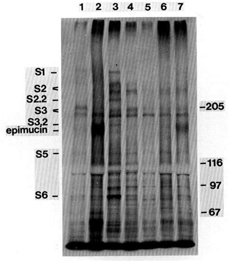 Glycoprotein synthesis by crude membrane fractions from different ...