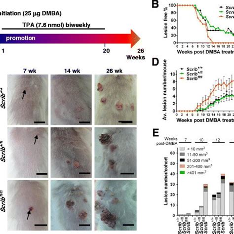 Scrib Deficiency Facilitates DMBA TPA Induced Epidermal Lesion Growth