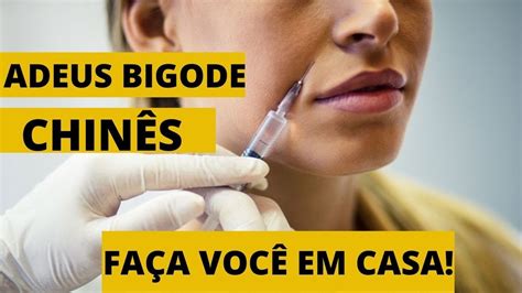 Como ACABAR o BIGODE CHINÊS RECEITA MILAGROSA YouTube