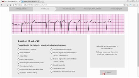 ekg practice test pdf
