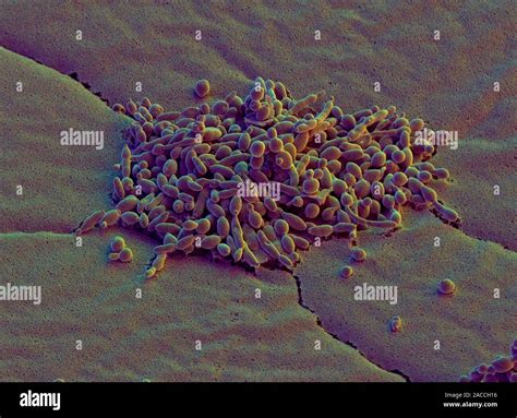 Las células de levadura Color análisis micrografía de electrones SEM