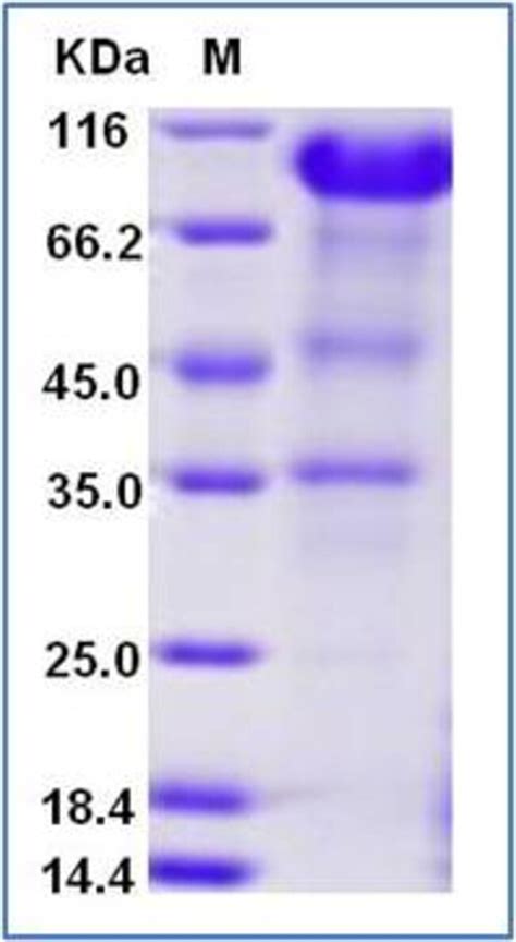 Sino Biological Human IL 6R Protein Fc AVI Tag Biotinylated 100ug