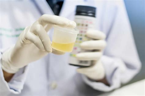 Urine Drug Test Detection Times Rapid Detect Inc