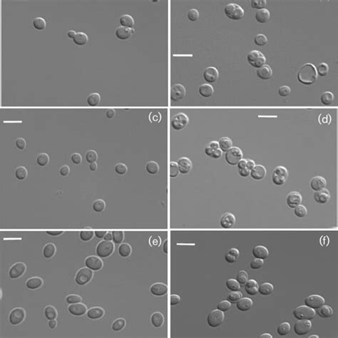 Pdf Three Novel Ascomycetous Yeast Species Of The Kazachstania Clade