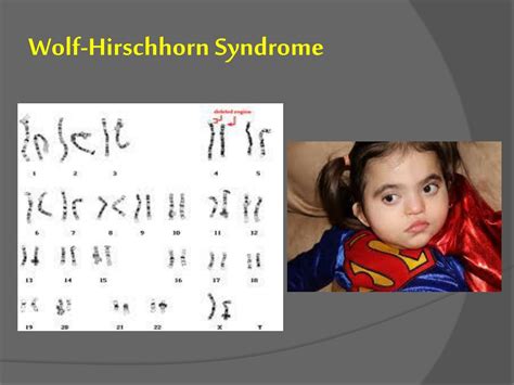 Ppt H Uman Chromosome And Chromosome Behavior Powerpoint Presentation