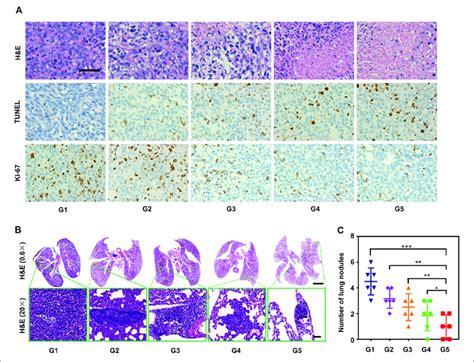 In Vivo Study Of The Antitumor And Anti Metastasis Effect Of