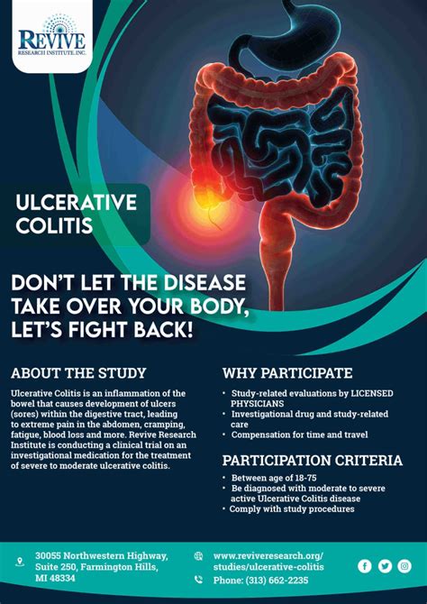 Ulcerative Colitis Clinical Trials - Ulcerative colitis treatment