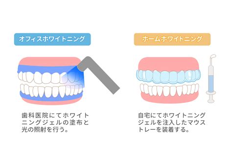 ホワイトニングは1回で効果がある？白さを実感する回数と持続期間を解説｜間瀬デンタルクリニック 千葉県富津市の歯科・歯医者 木更津市