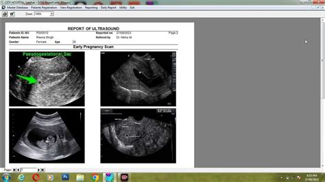 Ultrasound Reporting Software Youtube