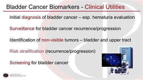 Dr Peter Black Urine Markers For Bladder Cancer The Ideal Marker