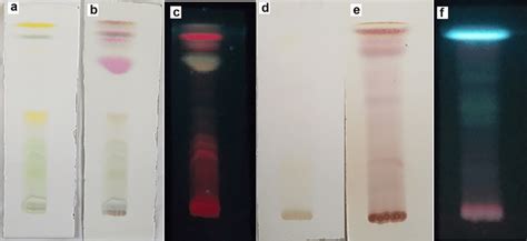 Tlc Chromatogram Of The Leaf And Stem Bark Of H Loribunda Respectively Download Scientific