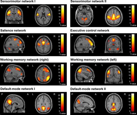 Spatial Maps Of Selected Resting State Networks Rsns From The Group Download Scientific