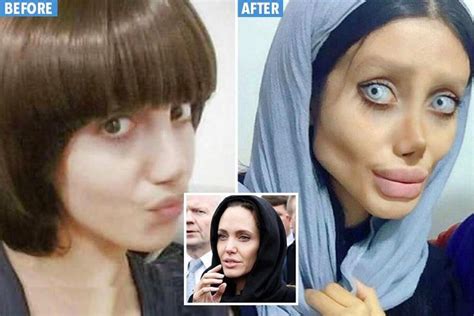 Teen Branded Zombie After Undergoing 50 Surgeries To Look Like