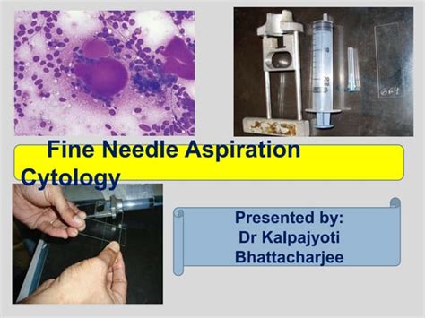 Fine Needle Aspiration Cytology Fnac Ppt