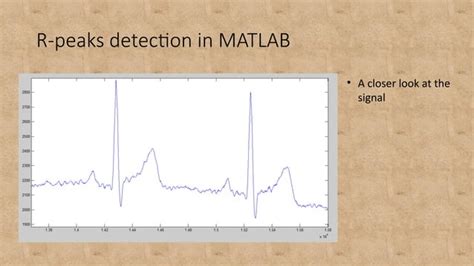 Ecg R Peak Detection Ppt