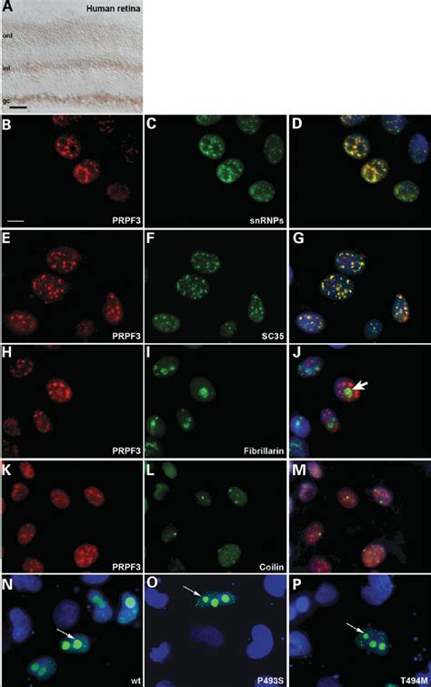 Expression And Subcellular Localization PRPF3 A Immunolocalization