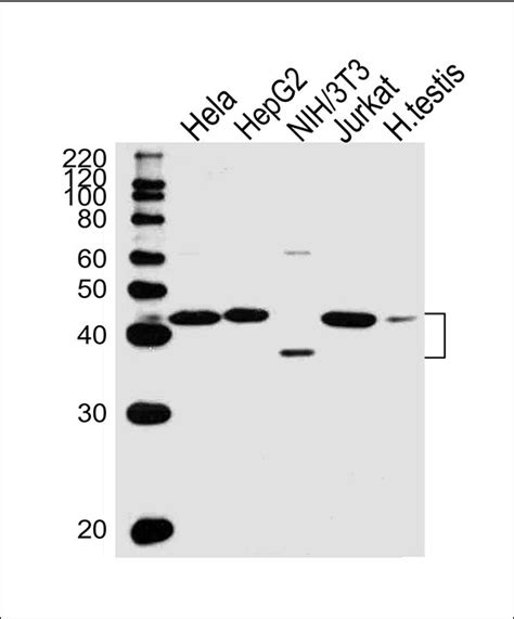 Tbp Antibody Mouse Monoclonal Antibody Mab Ihc P Wb Buy Now