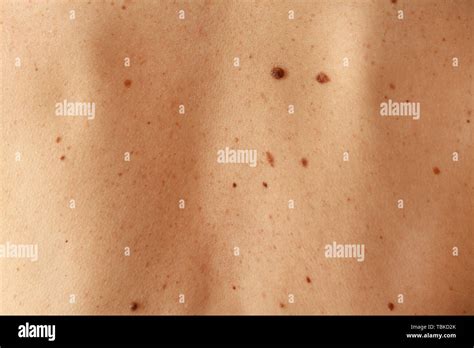 Moles Skin High Resolution Stock Photography and Images - Alamy