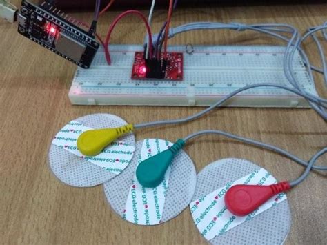 AD8232 ECG Sensor Arduino Interfacing With ECG Graph 45 OFF