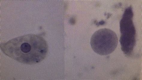 Lab 2 Protozoa And Vectors Flashcards Quizlet