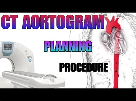 CT AORTOGRAM : planning and procedure explained - YouTube