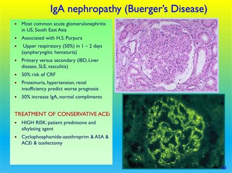 PPT - Acute Glomerulonephritis PowerPoint Presentation - ID:3066382