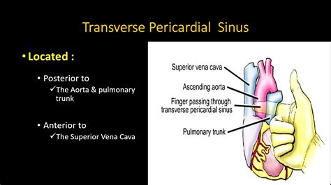 Pericardial Anatomy