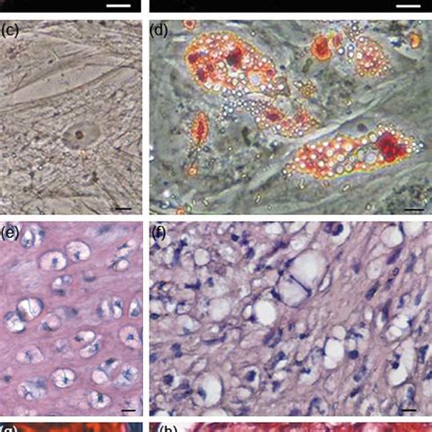 Osteogenic Differentiation Of MSC The Figure Shows Alizarin Red S