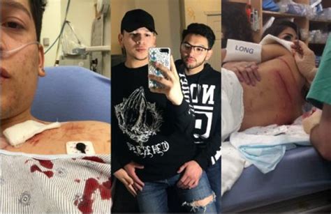 Coppia gay aggredita per strada perché si teneva per mano