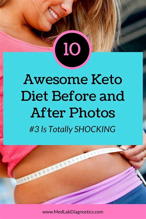 10 Awesome Keto Diet Before and After Photos | MedLabDiagnostics.org