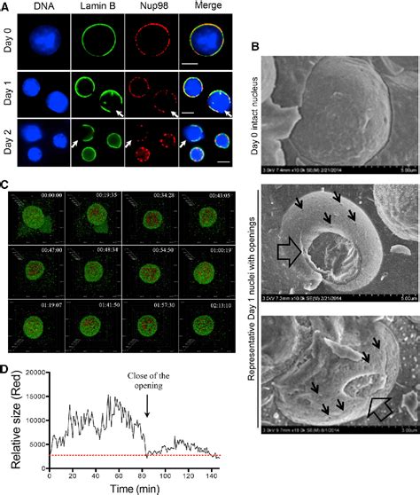 Figure From Nuclear Condensation During Mouse Erythropoiesis Requires