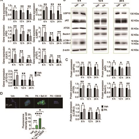 PA Affected Autophagic Activity And Expression Of USP10 Of HepG2