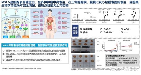 CAR T全球在研项目实体瘤篇 知乎