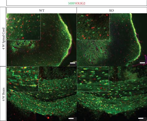 Myelinating oligodendrocytes of the spinal cord and brain at 4 weeks of ...