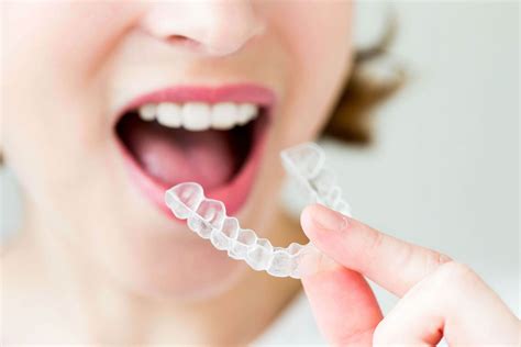 Invisalign Clear Aligners Teeth Straightening In Turkey Istanbul