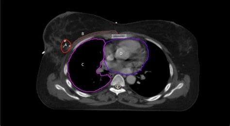 Ct Anatomy Diagram Quizlet