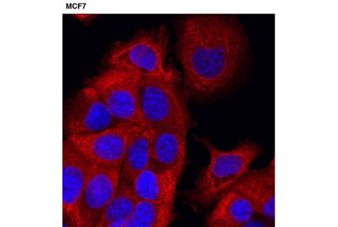 Keratin D E Xp Rabbit Mab Cell Signaling Technology