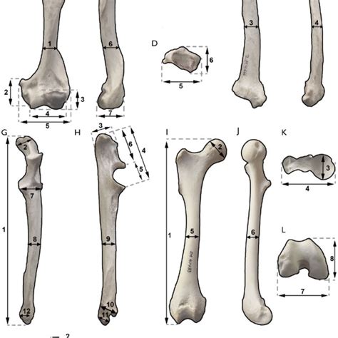 Comparison Of The Left Distal Epiphysis Of The Radius Of The Specimen Download Scientific