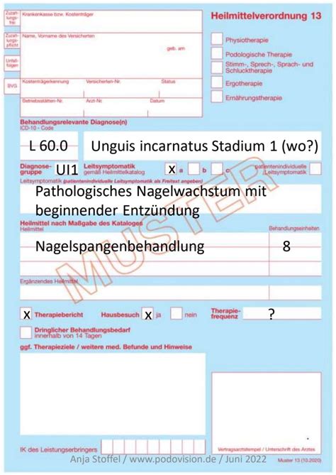 Eingewachsene Fu N Gel Podologie Engelmann