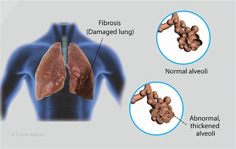 Health Condition : Symptoms, Causes, Treatment and More