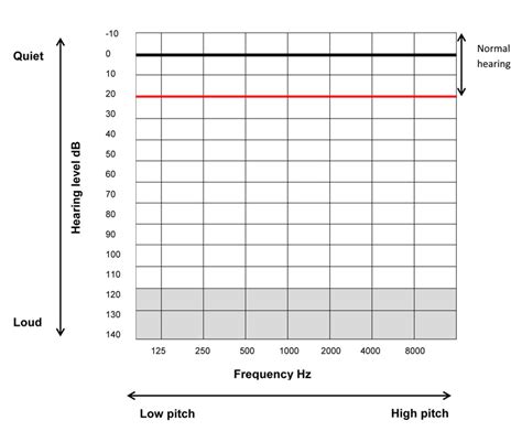 Audiograms Explained Hearing Healthcare Centre