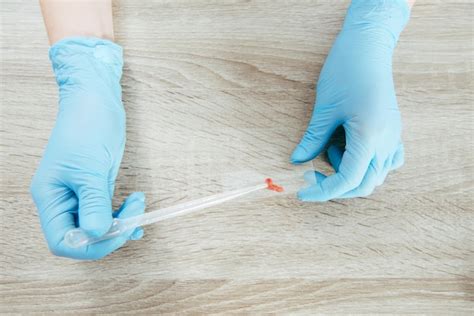 Premium Photo Cropped View Of Doctor In Latex Gloves Holding Pipette