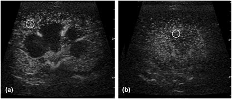 Pilot Study Use Of Contrast Enhanced Ultrasonography In Feline Renal