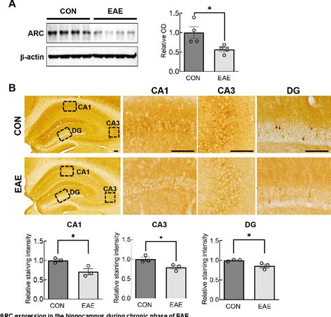 Figure 6 from Changes in structural plasticity of hippocampal neurons ... 