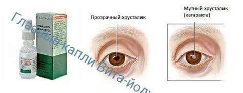 Вита-йодурол глазные капли инструкция по применению, цена, отзывы